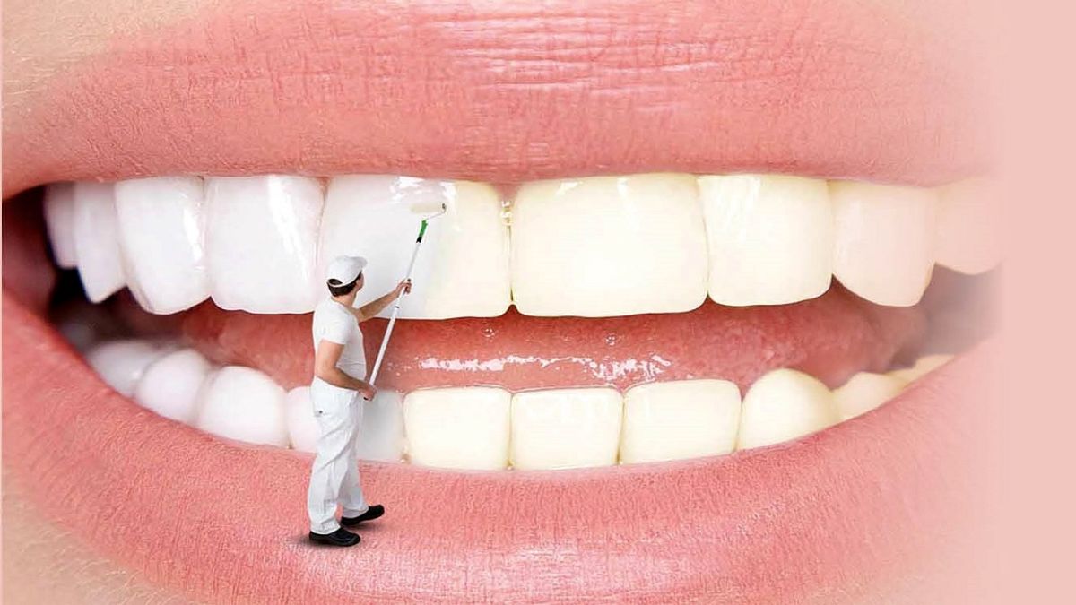 روش‌های خانگی برای سفید کردن دندان ها